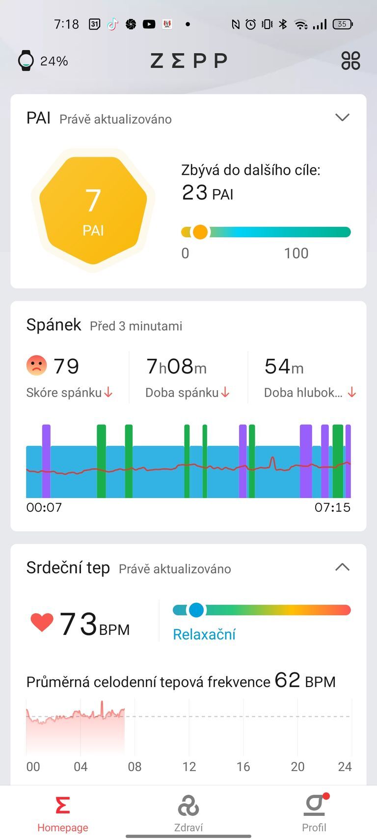 Amazfit GTR 3 Pro