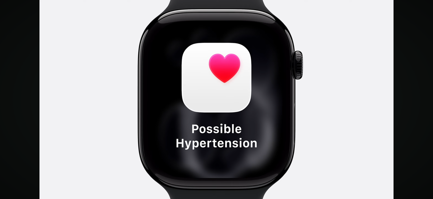 Apple Watch 11