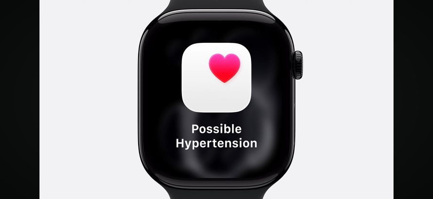 Apple Watch 11
