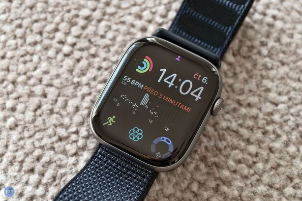 Apple Watch 11
