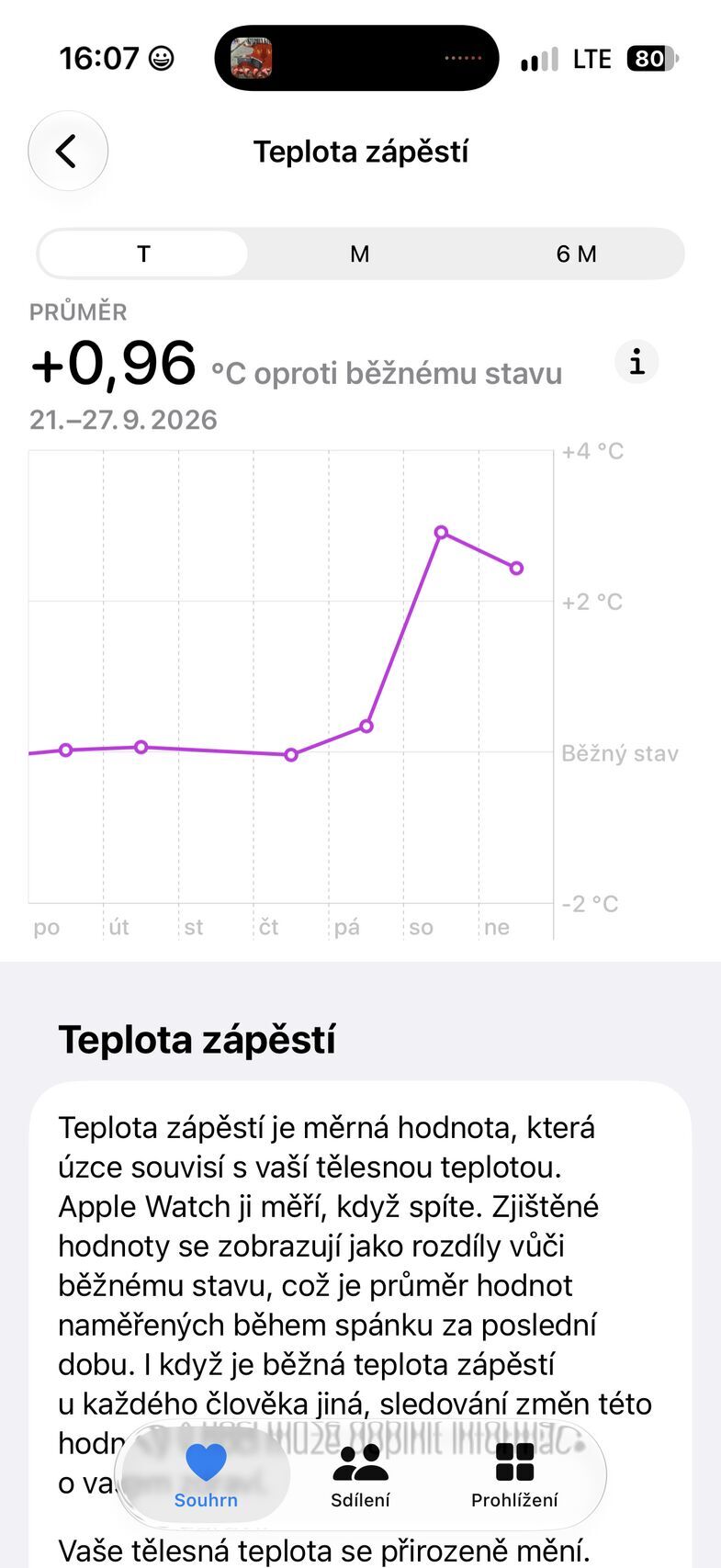 Apple Watch Ultra 4