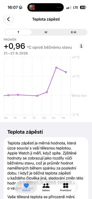 Apple Watch Ultra 4