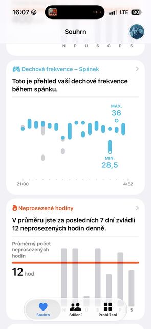 Apple Watch Ultra 4