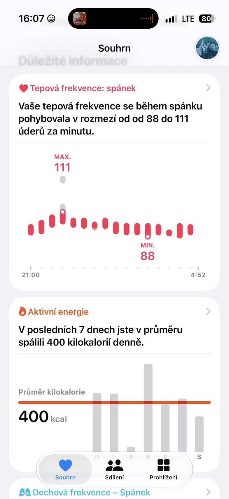 Apple Watch Ultra 4