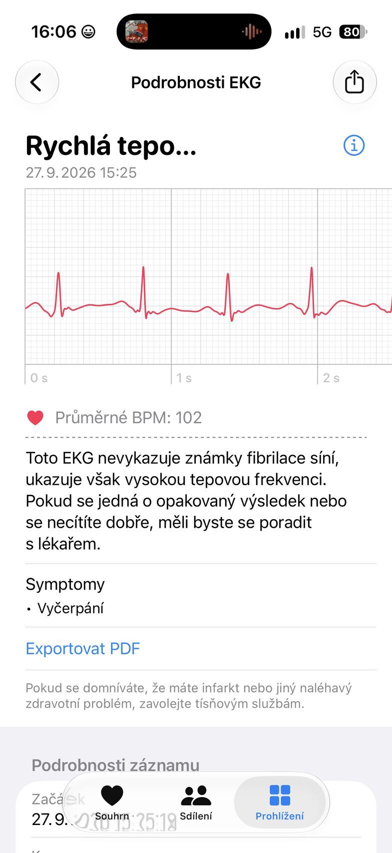Apple Watch Ultra 4