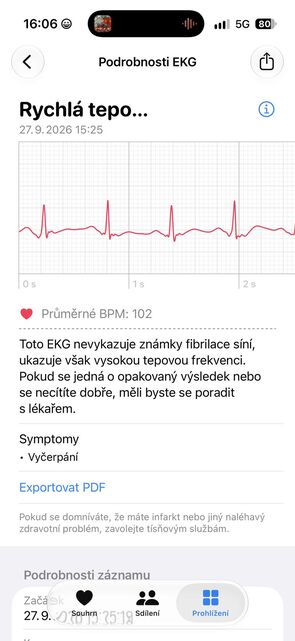 Apple Watch Ultra 4