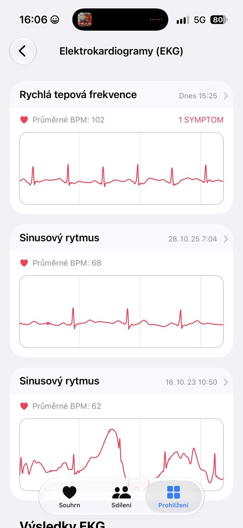 Apple Watch Ultra 4