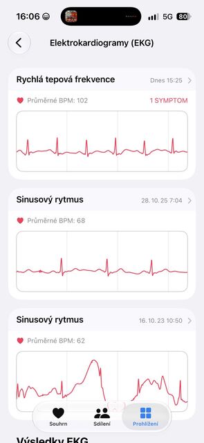 Apple Watch Ultra 4