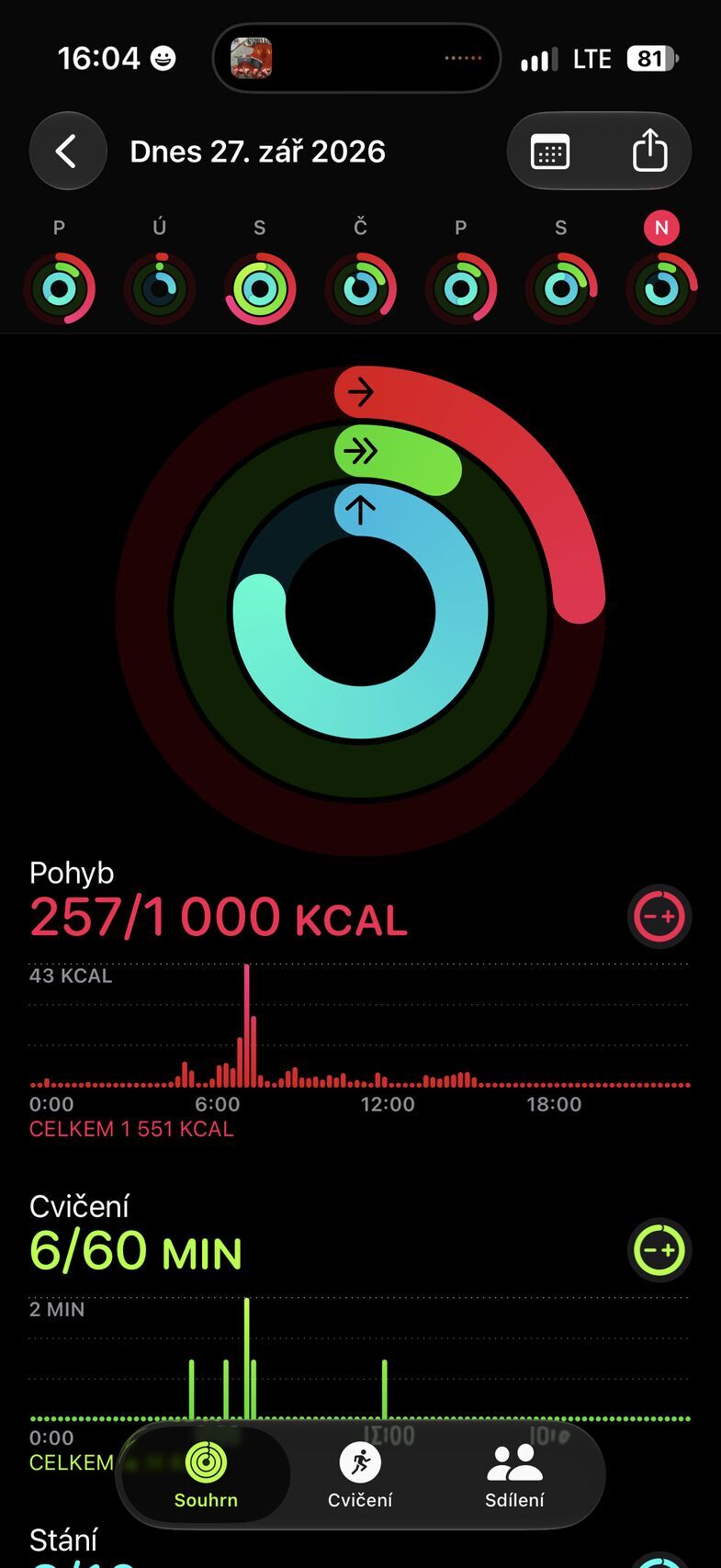 Apple Watch Ultra 4