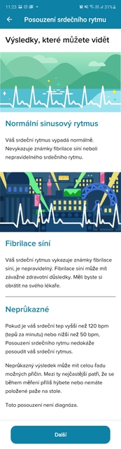 Fitbit Sense