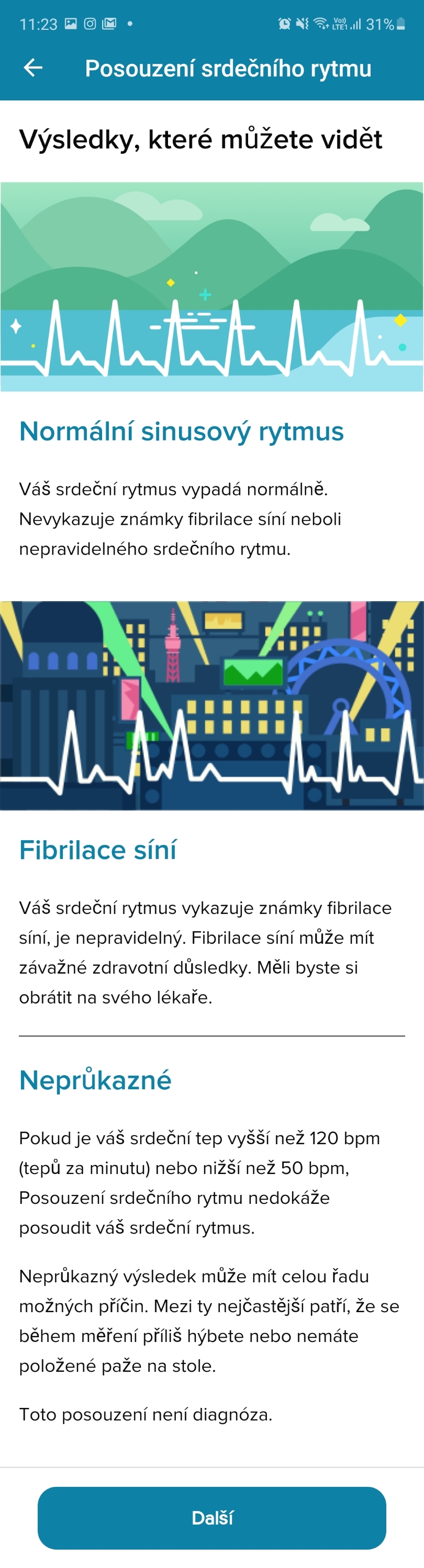 Fitbit Sense