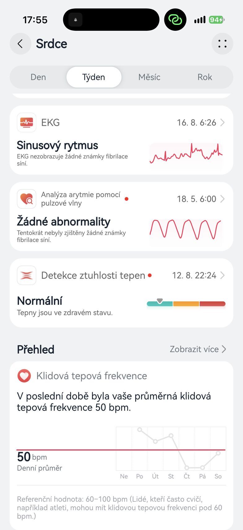 Huawei Watch GT 7 Pro