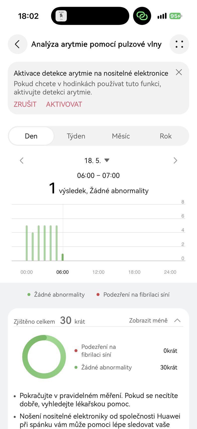 Huawei Watch GT 7 Pro