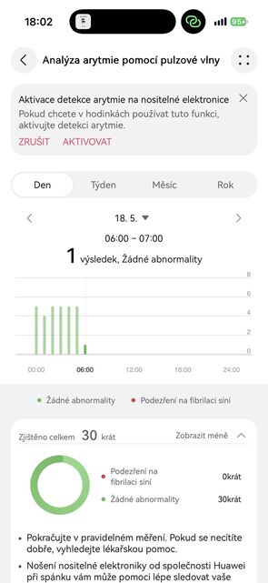 Huawei Watch GT 7 Pro