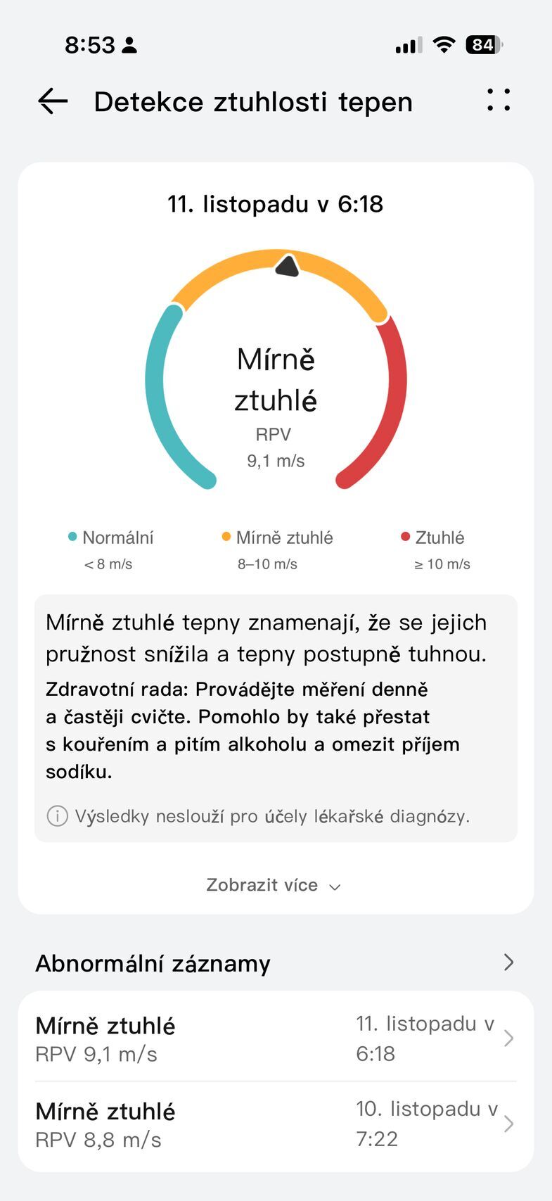 Huawei Watch Ultimate 2
