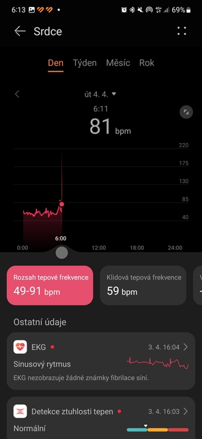 Huawei Watch Ultimate