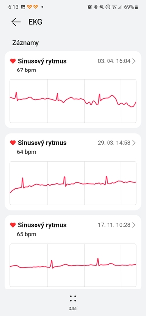 Huawei Watch Ultimate