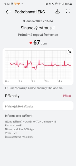 Huawei Watch Ultimate