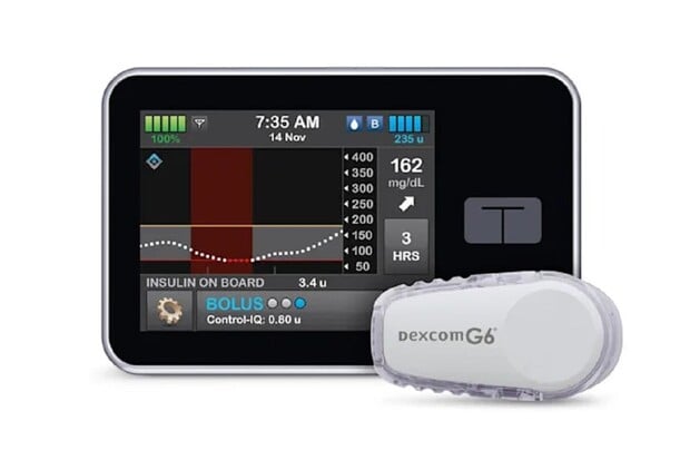 Úřad FDA schválil první inzulinovou pumpu, která používá aplikaci na smartphonu