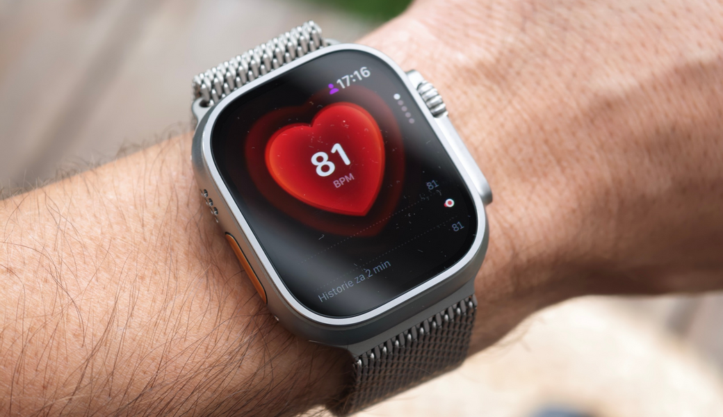 Apple Watch Ultra 4