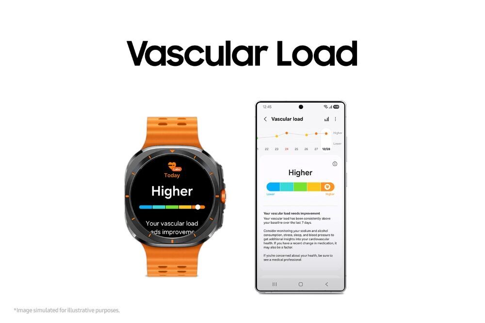Vascular Load