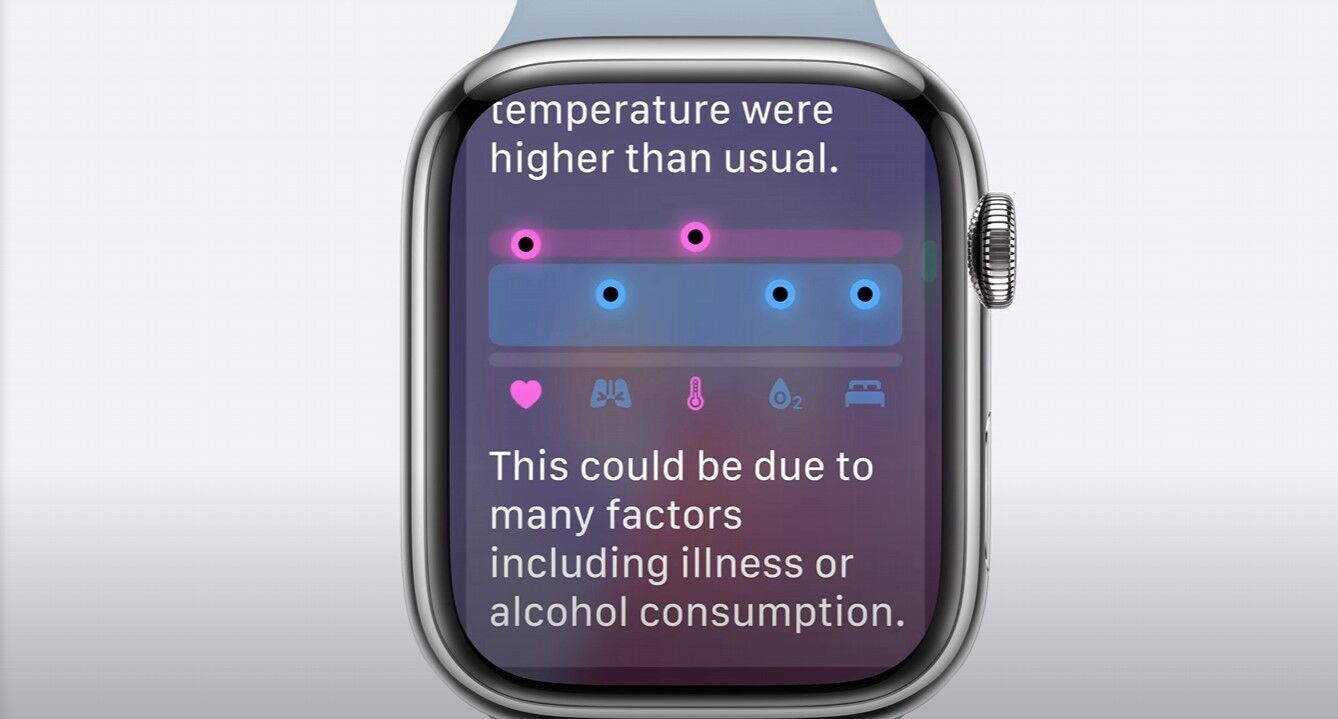 watchOS 11