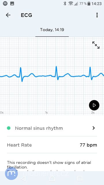 Withings Move ECG