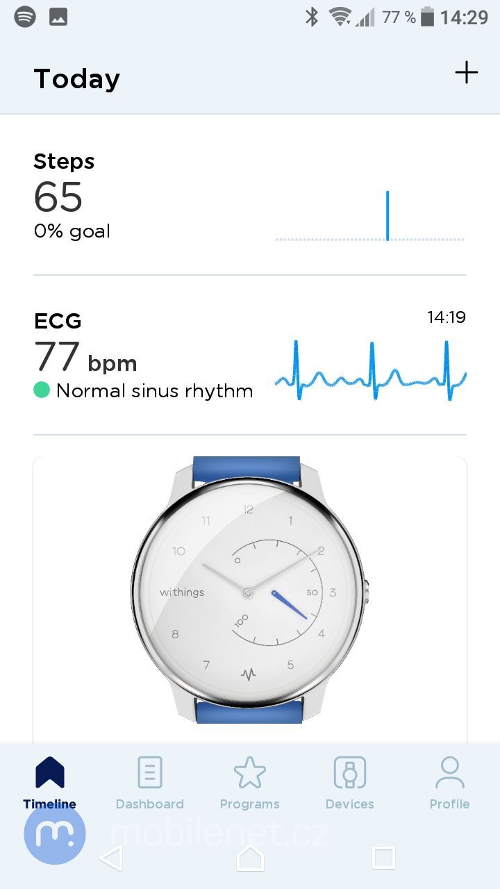 Withings Move ECG