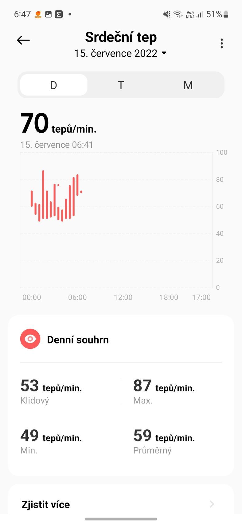 Xiaomi Mi Band 7