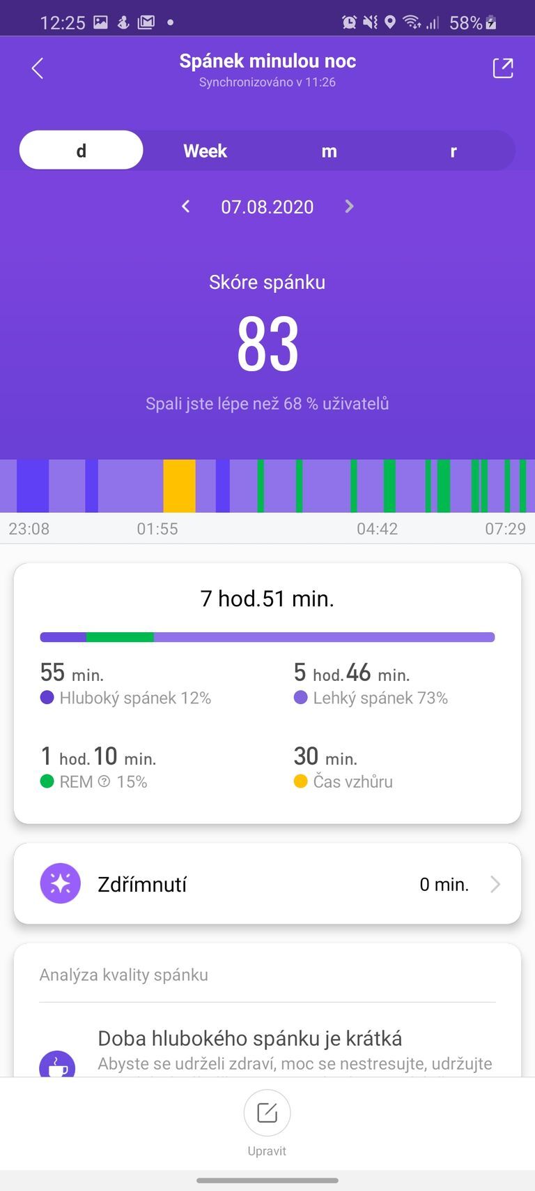 Xiaomi Mi Smart Band 5