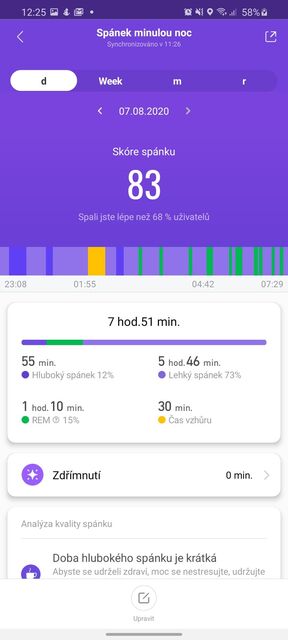 Xiaomi Mi Smart Band 5