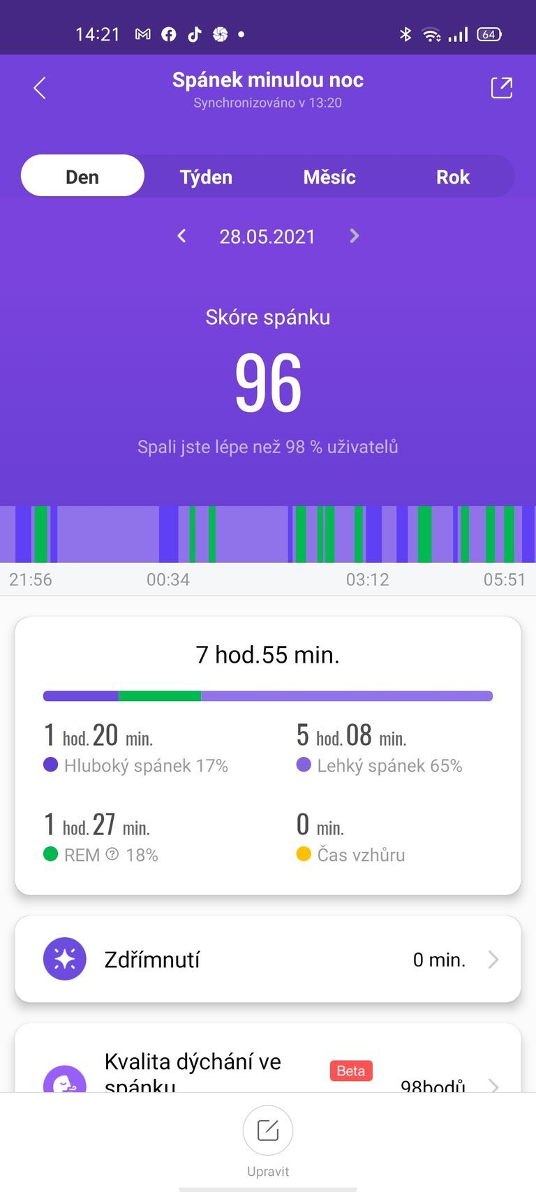 Xiaomi Mi Smart Band 6