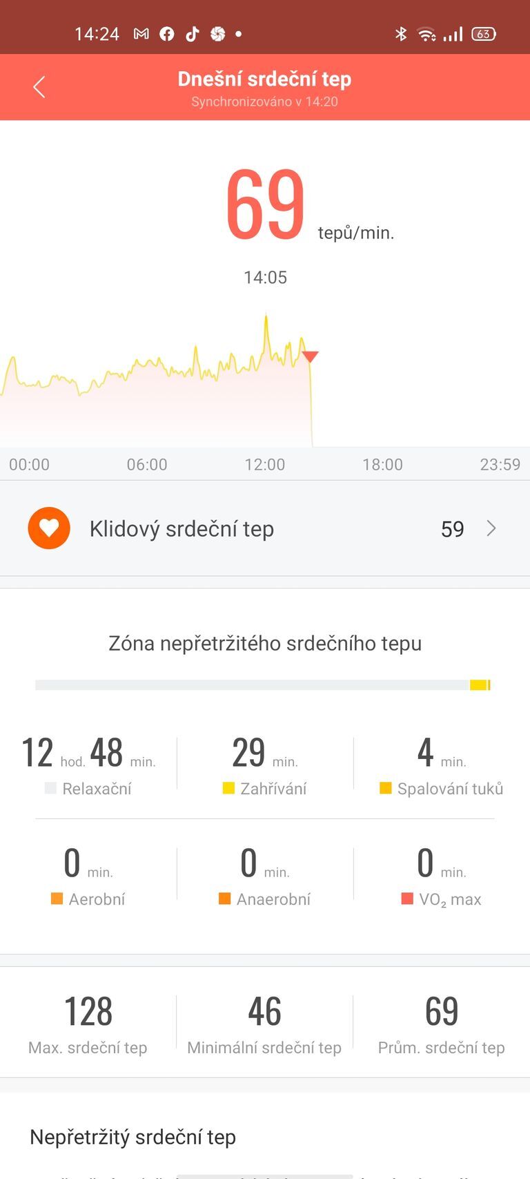 Xiaomi Mi Smart Band 6