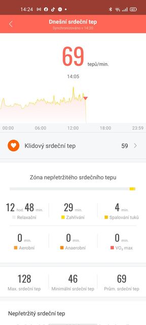 Xiaomi Mi Smart Band 6