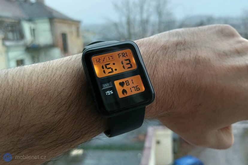 Xiaomi Redmi Watch 2 Lite