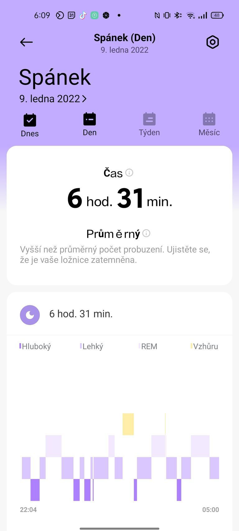 Xiaomi Redmi Watch 2 Lite