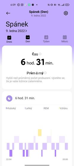 Xiaomi Redmi Watch 2 Lite