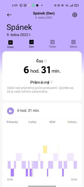 Xiaomi Redmi Watch 2 Lite