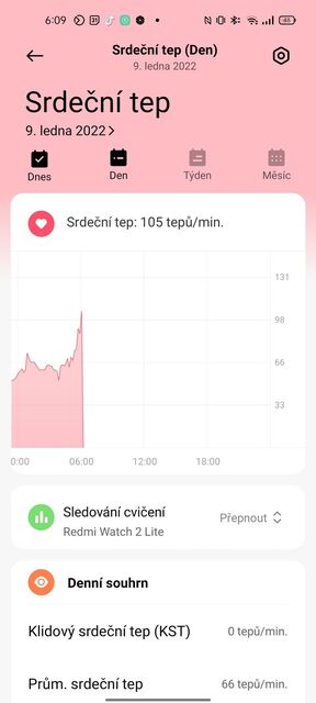 Xiaomi Redmi Watch 2 Lite