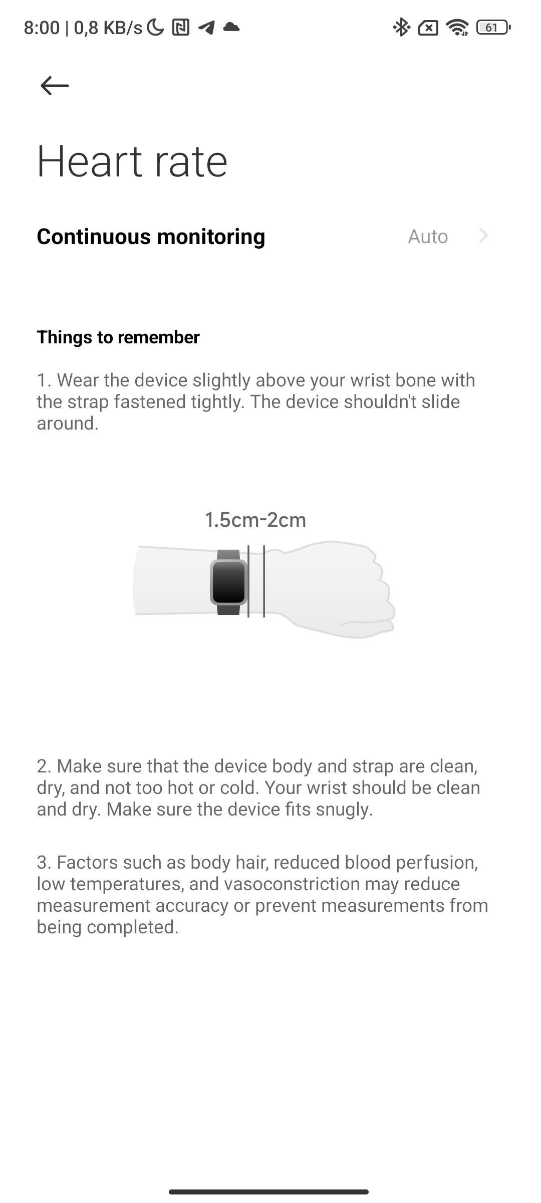 Xiaomi Redmi Watch 3