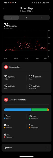 Xiaomi Redmi Watch 4