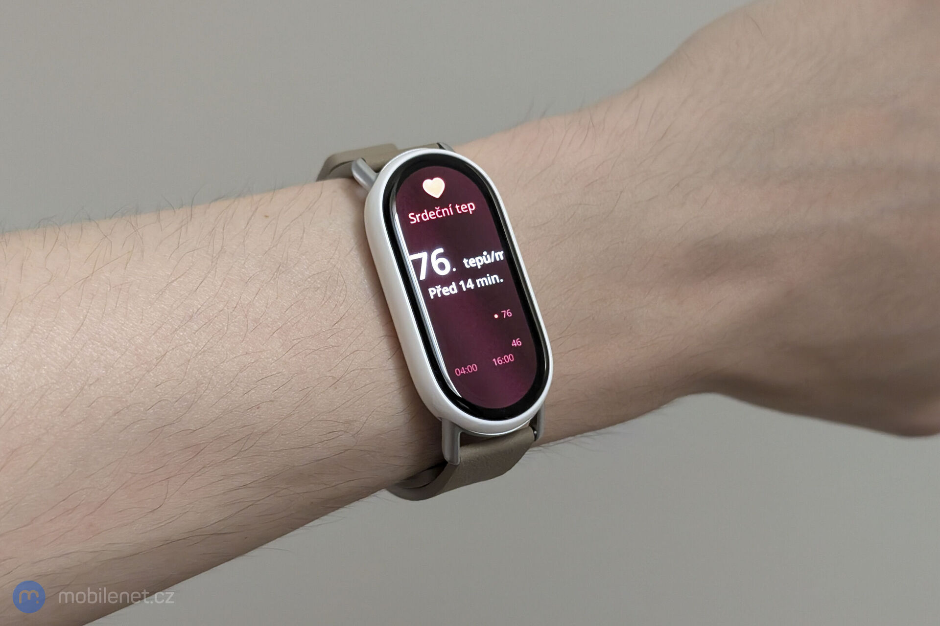 Xiaomi Smart Band 10