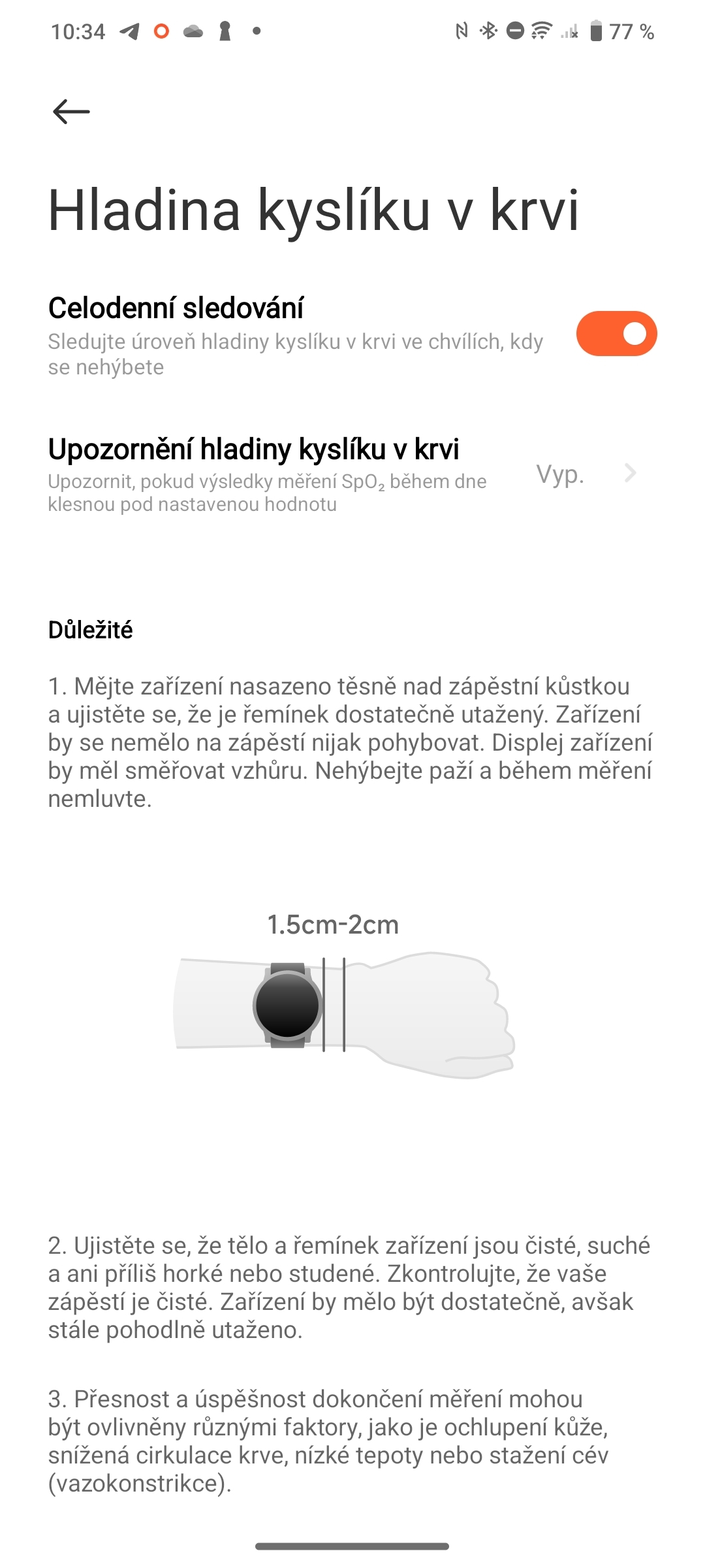 Xiaomi Watch 2