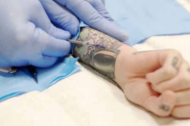 Mladá biohackerka si nechala do zápěstí implantovat RFID čip k odemykání Tesly