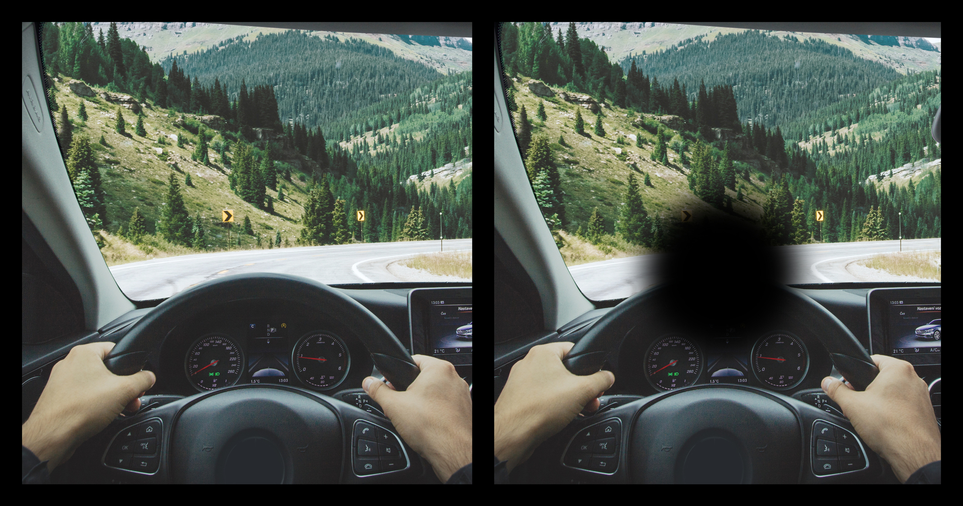 Věkem podmíněná makulární degenerace