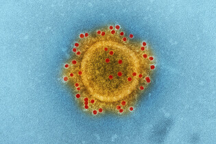 Světová zdravotnická organizace přejmenuje opičí neštovice na MPOX