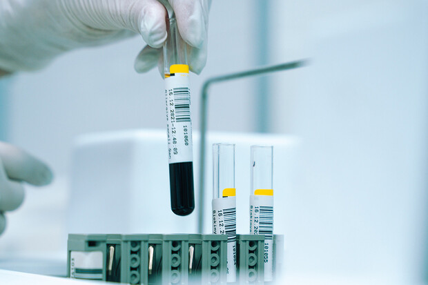 Vědci poprvé podali lidem transfuzi krve, která byla vypěstovaná v laboratoři