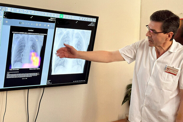 První nemocnice v ČR testuje diagnózy pomocí umělé inteligence