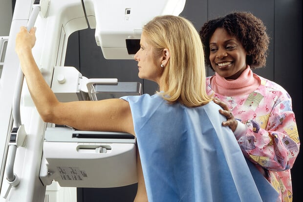 Vše, co potřebujete vědět o mamografii
