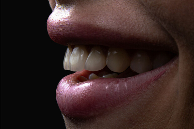 Bělení zubů peroxidem či pomocí sody? Jednoduchá cesta ke zničení skloviny